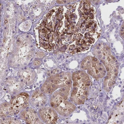 Immunohistochemistry-Paraffin: Tau Antibody [NBP2-49603] - Staining of human kidney shows strong cytoplasmic positivity in cells in glomeruli and moderate cytoplasmic positivity in cells in tubules.