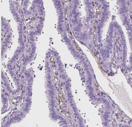 Immunohistochemistry-Paraffin: Tau Antibody [NBP2-49603] -Staining of human fallopian tube shows negative positivity in glandular cells as expected.