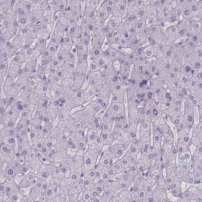 Immunohistochemistry-Paraffin: Tau Antibody [NBP2-49603] - Staining of human liver shows no positivity in hepatocytes as expected.