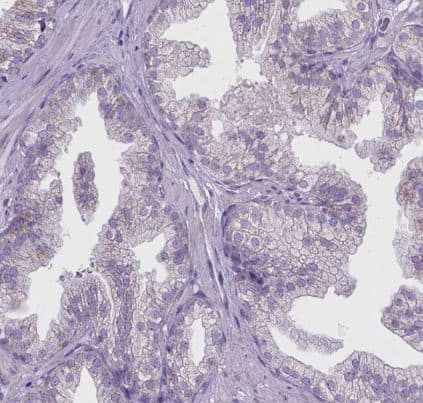 Immunohistochemistry-Paraffin: CTAG2 Antibody [NBP2-49659] - Staining of human prostate shows no positivity in glandular cells as expected.