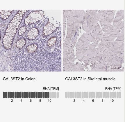 Immunohistochemistry-Paraffin: Galactose-3-O-sulfotransferase 2/GAL3ST2 Antibody [NBP2-49670] -  Analysis in human colon and skeletal muscle tissues using NBP2-49670 antibody. Corresponding GAL3ST2 RNA-seq data are presented for the same tissues.