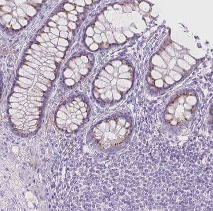 Immunohistochemistry-Paraffin: Galactose-3-O-sulfotransferase 2/GAL3ST2 Antibody [NBP2-49670] - Staining of human colon shows strong cytoplasmic granular positivity in enterocytes.