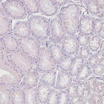 Immunohistochemistry-Paraffin: Galactose-3-O-sulfotransferase 2/GAL3ST2 Antibody [NBP2-49670] - Staining of human stomach shows negative cytoplasmic positivity in glandular cells as expected.
