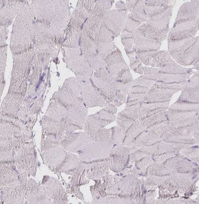 Immunohistochemistry-Paraffin: Galactose-3-O-sulfotransferase 2/GAL3ST2 Antibody [NBP2-49670] - Staining of human skeletal muscle shows negative cytoplasmic positivity in myocytes as expected.