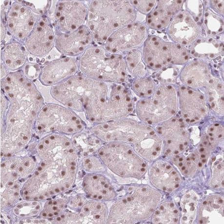  HES7 Antibody [NBP2-49675] - Staining of human kidney shows moderate nuclear positivity in cells in tubules.