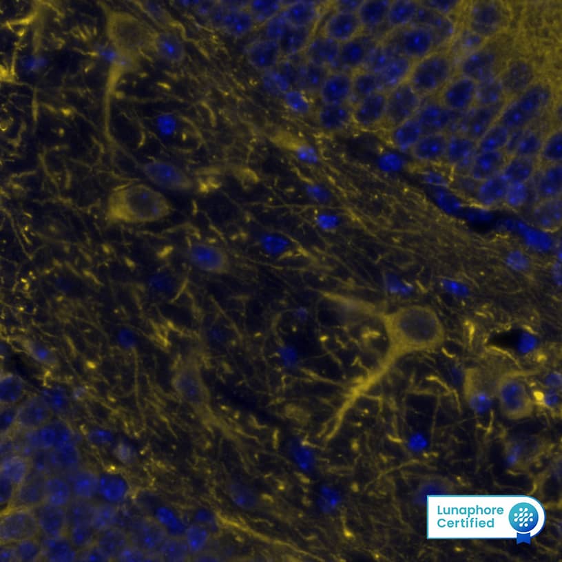 MAP2 was detected in immersion fixed paraffin-embedded sections of mouse Hippocampus using Mouse Anti-Human Mouse MAP2, Monoclonal Antibody (Catalog # NBP2-50032) at 1:12,000 dilution at 37 ° Celsius for 4 minutes. Before incubation with the primary antibody, tissue underwent an all-in-one dewaxing and antigen retrieval preprocessing using PreTreatment Module (PT Module) and Dewax and HIER Buffer H (pH 9; Epredia Catalog # TA-999-DHBH). Tissue was stained using the Alexa Fluor™ 647 Goat anti-Mouse IgG Secondary Antibody at 1:200 at 37 ° Celsius for 2 minutes. (Yellow; Lunaphore Catalog # DR647MS) and counterstained with DAPI (blue; Lunaphore Catalog # DR100). Specific staining was localized to the cytoplasm. Protocol available in COMET™ Panel Builder.​​