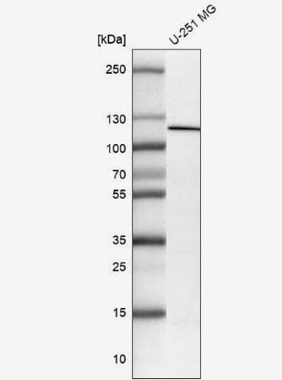 Western Blot: NLRP3/NALP3 Antibody (CL0210) [NBP2-52879] -Analysis in human cell line U-251 MG.