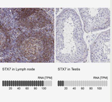 Immunohistochemistry-Paraffin Syntaxin 7 Antibody (CL0257)