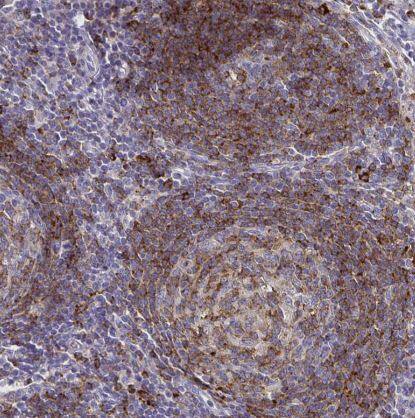 Immunohistochemistry-Paraffin-Syntaxin 7 Antibody (CL0257)-NBP2-52893- Staining of human lymph node shows moderate to strong cytoplasmic positivity in lymphoid cells.