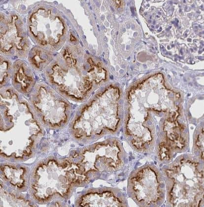 Immunohistochemistry-Paraffin-Syntaxin 7 Antibody (CL0257)-NBP2-52893- Staining of human kidney shows strong apical membrane positivity in cells in proximal tubules.