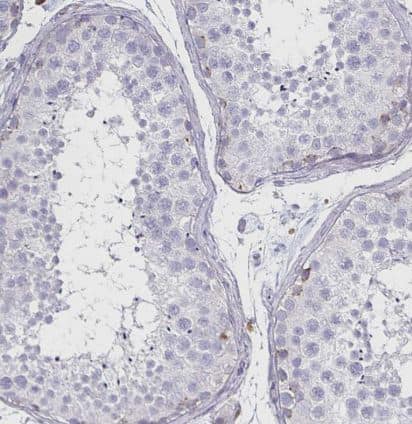 Immunohistochemistry-Paraffin-Syntaxin 7 Antibody (CL0257)-NBP2-52893- Staining of human testis shows no positivity in cells in seminiferous ducts as expected.