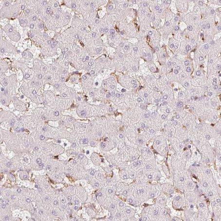 Immunohistochemistry-Paraffin: MMR/CD206/Mannose Receptor Antibody (CL0387) [NBP2-52927] -Staining of human liver shows moderate positivity in kupffer cells.