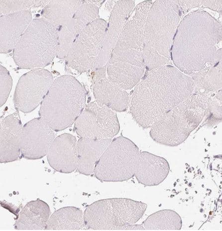 Immunohistochemistry-Paraffin: MMR/CD206/Mannose Receptor Antibody (CL0387) [NBP2-52927] -Staining of human skeletal muscle shows no positivity in myocytes as expected.