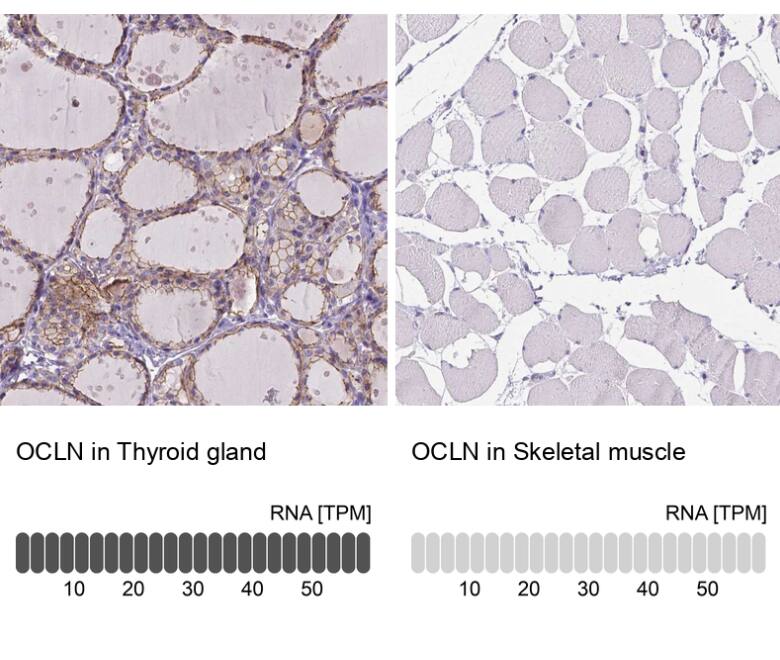 <b>Orthogonal Strategies Validation. </b>Analysis in human thyroid gland and skeletal muscle tissues using NBP2-52973 antibody. Corresponding OCLN RNA-seq data are presented for the same tissues.