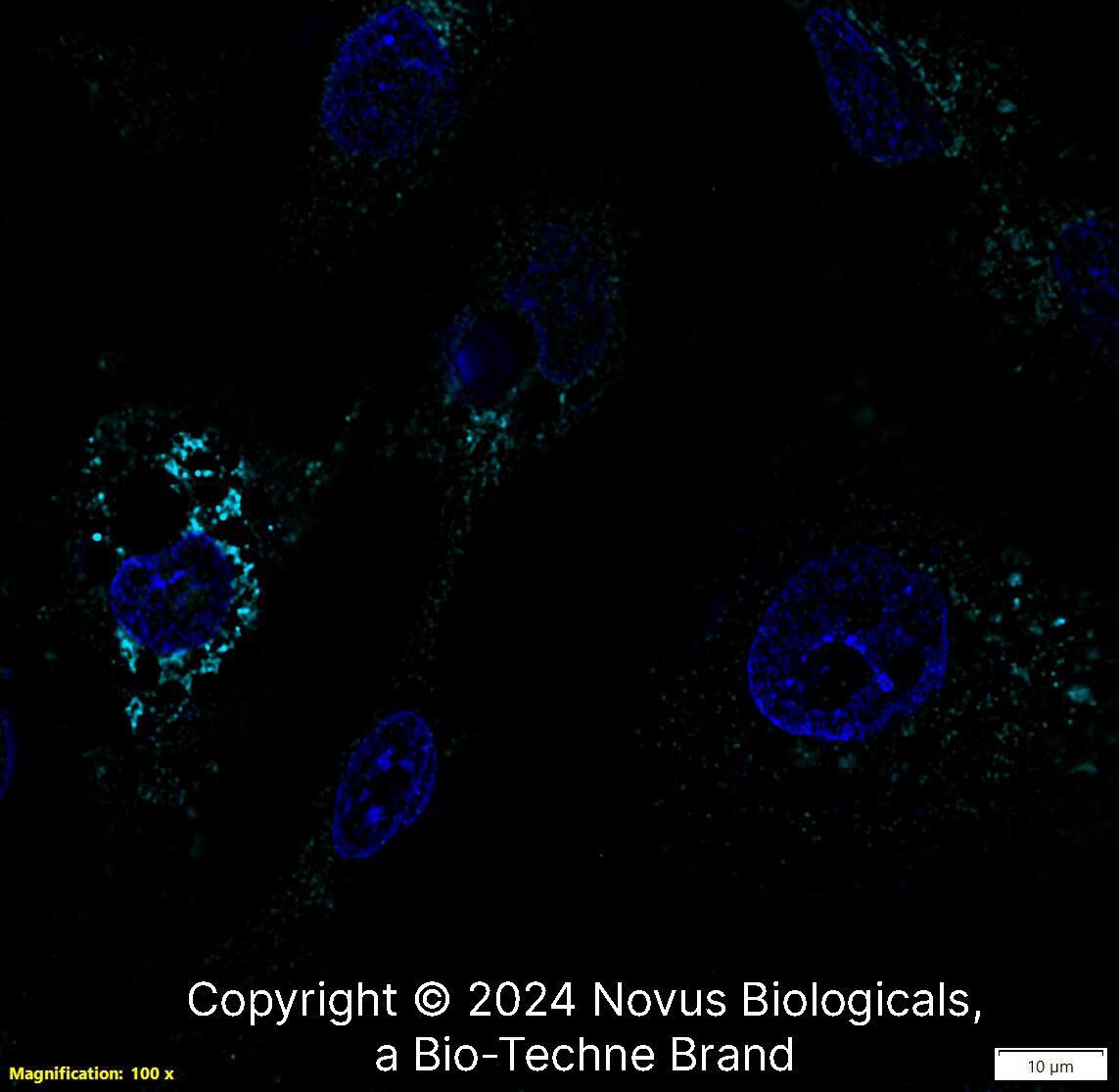 Apolipoprotein A-I/ApoA1 was detected in immersion fixed HepG2 human hepatocellular carcinoma cell line using Rabbit anti- Apolipoprotein A-I/ApoA1 Affinity Purified Polyclonal Antibody conjugated to Alexa Fluor ® 647 (Catalog # NBP2-52979AF647) (light blue) at 10 µg/mL overnight at 4C. Cells were counterstained with DAPI (dark blue). Cells were imaged using a 100X objective and digitally deconvolved.