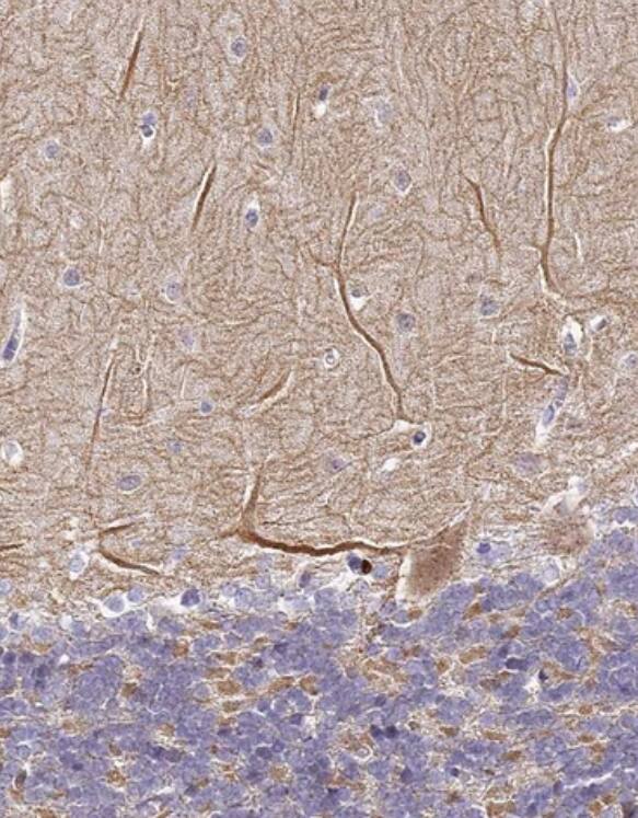 Staining of human Cerebellum shows weak granular cytoplasmic positivity in Purkinje cells.