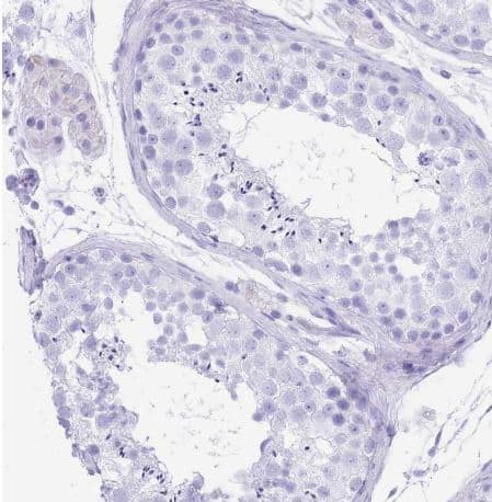 Immunohistochemistry-Paraffin: OATP1B3/SLCO1B3/OATP8 Antibody [NBP2-54739] - Staining of human testis shows no positivity in cells in seminiferous ducts as expected.