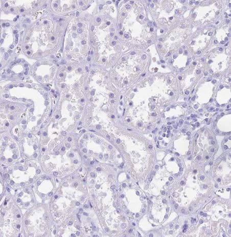 Immunohistochemistry-Paraffin: OATP1B3/SLCO1B3/OATP8 Antibody [NBP2-54739] - Staining of human kidney shows no positivity in cells in tubules as expected.