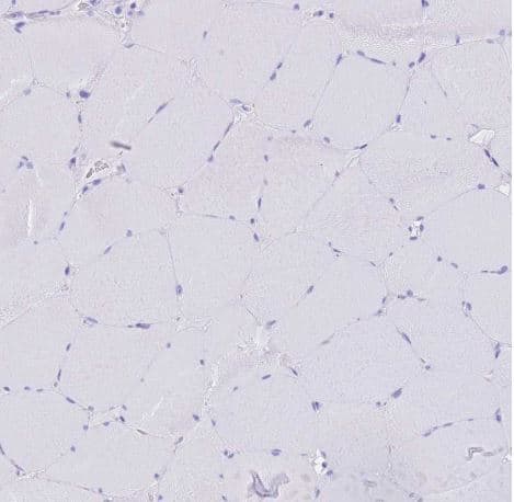 Immunohistochemistry-Paraffin: OATP1B3/SLCO1B3/OATP8 Antibody [NBP2-54739] - Staining of human skeletal muscle shows no positivity in myocytes as expected.