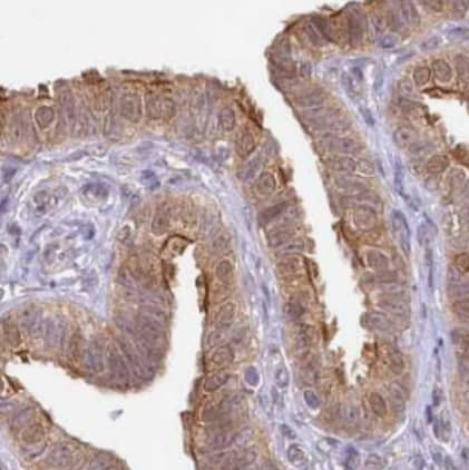 Immunohistochemistry-Paraffin Aminopeptidase B/RNPEP Antibody