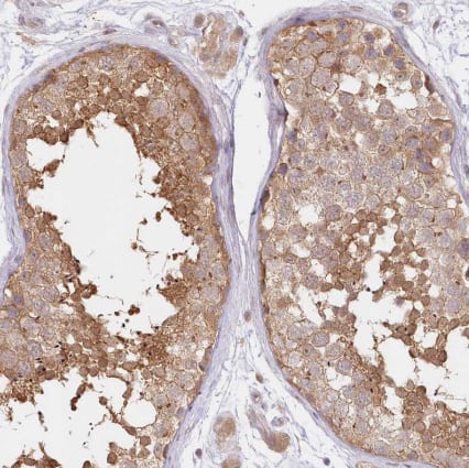 Immunohistochemistry-Paraffin Aminopeptidase B/RNPEP Antibody