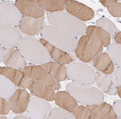 Immunohistochemistry-Paraffin: Aminopeptidase B/RNPEP Antibody [NBP2-54975] -Staining of human skeletal muscle shows moderate cytoplasmic positivity in myocytes.