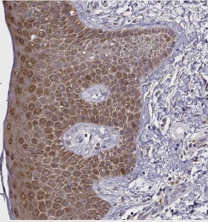 Immunohistochemistry-Paraffin: BACH1 Antibody [NBP2-55113] -Staining of human skin shows strong cytoplasmic positivity in squamous epithelial cells.