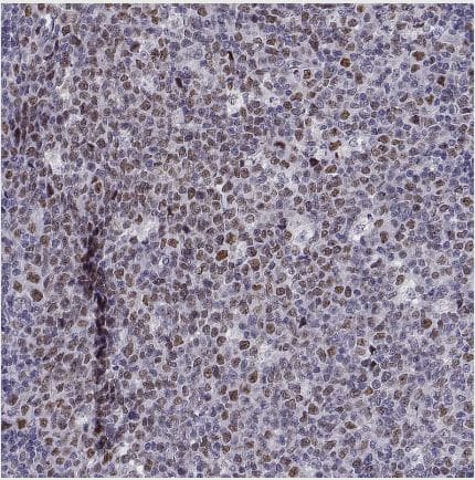 Immunohistochemistry-Paraffin: BACH1 Antibody [NBP2-55113] - Staining of human tonsil shows moderate nuclear positivity in germinal center cells.