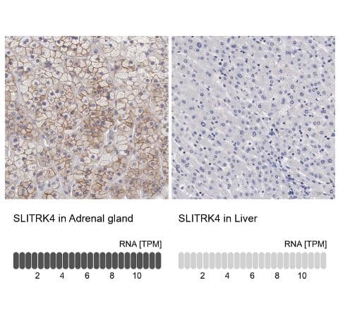 Immunohistochemistry-Paraffin: SLITRK4 Antibody [NBP2-55121]-analysis in human adrenal gland and liver tissues using  antibody. Corresponding SLITRK4 RNA-seq data are presented for the same tissues.