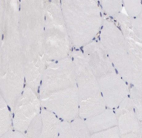 Immunohistochemistry-Paraffin: SLITRK4 Antibody [NBP2-55121] -Staining of human skeletal muscle shows no membranous positivity in myocytes as expected.