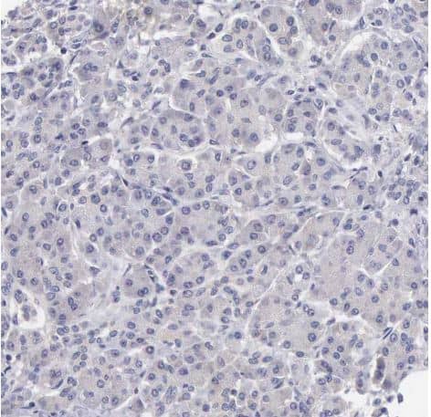 Immunohistochemistry-Paraffin: SLITRK4 Antibody [NBP2-55121] -Staining of human pancreas shows no membranous positivity in exocrine glandular cells as expected. 