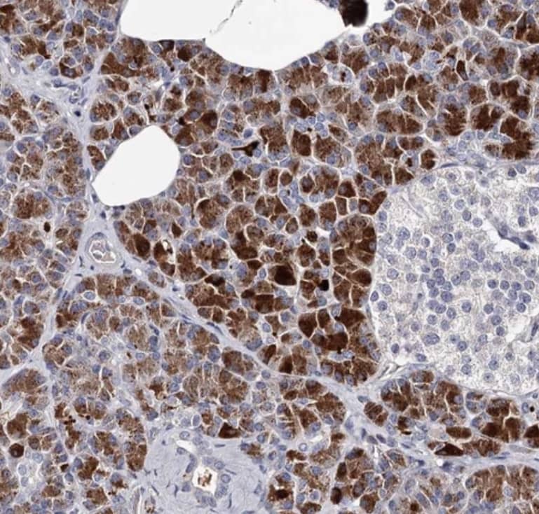 Immunohistochemistry-Paraffin RASSF6 Antibody - BSA Free