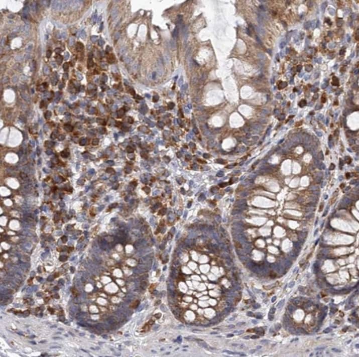 Immunohistochemistry-Paraffin RASSF6 Antibody - BSA Free