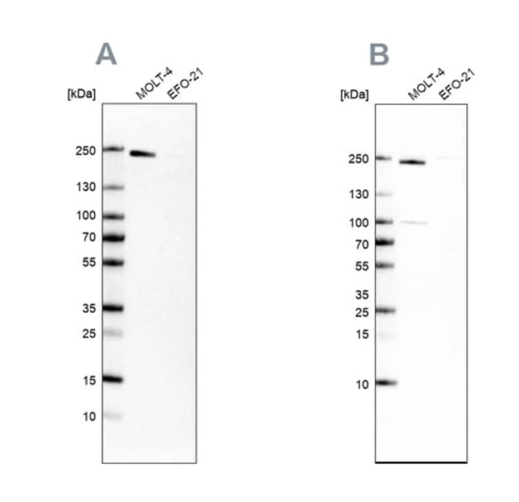 Analysis using Anti-PBRM1 antibody (A) shows similar pattern to independent antibody (B).