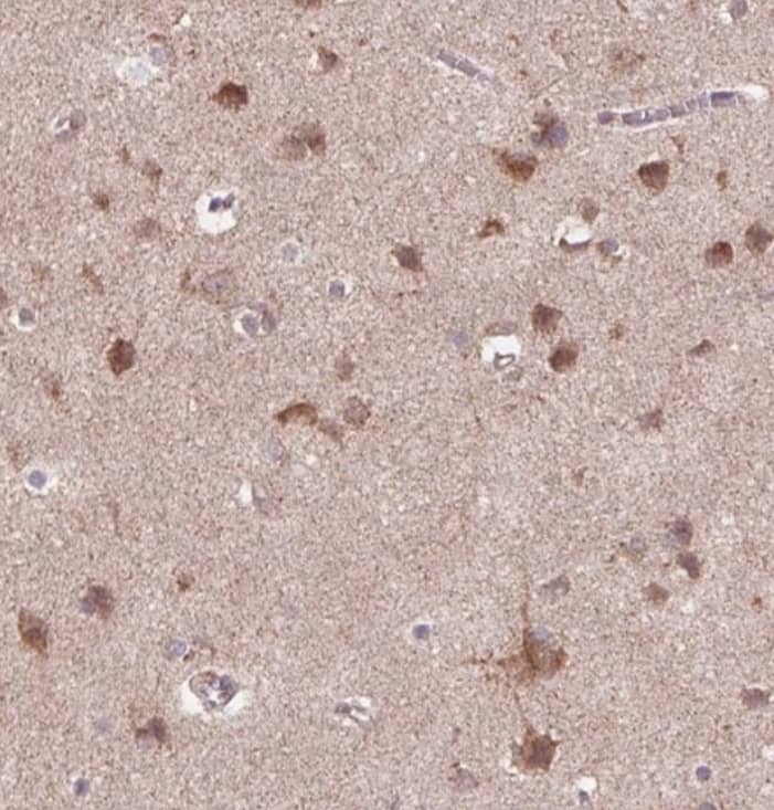 Staining of human cerebral cortex shows strong cytoplasmic positivity in neurons.