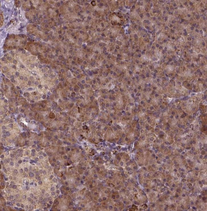 Staining of human pancreas shows strong cytoplasmic positivity in exocrine glandular cells.