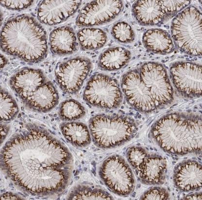 Immunohistochemistry-Paraffin: YIPF3 Antibody [NBP2-56181] - Staining of human stomach shows strong positivity in cytoplasm granular-membranous in glandular cells.