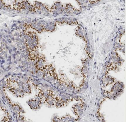 Immunohistochemistry-Paraffin: YIPF3 Antibody [NBP2-56181] - Staining of human prostate shows strong positivity in cytoplasm granular-membranous in glandular cells.