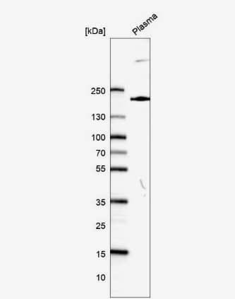 Western Blot: Plexin A3 Antibody [NBP2-56699] -Analysis in human plasma.