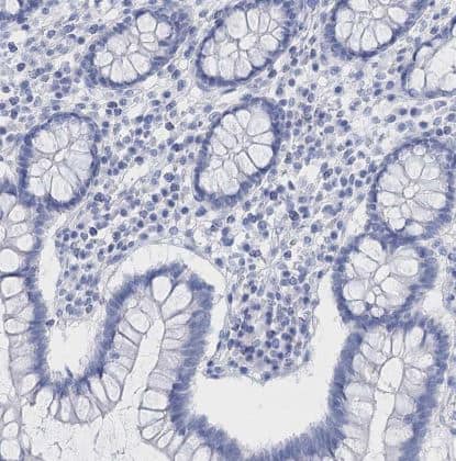 Immunohistochemistry-Paraffin: Lactalbumin Alpha Antibody [NBP2-56836] -  Staining of human testis shows no positivity in cells in seminiferous ducts as expected.