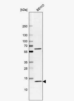 Western Blot: GLXR5 Antibody [NBP2-57059] -  Analysis in human cell line BEWO.