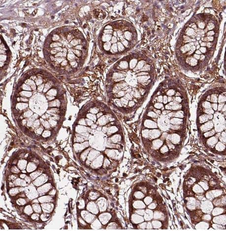 Immunohistochemistry-Paraffin: FAM21A Antibody [NBP2-57472] -Staining of human rectum shows strong cytoplasmic granular positivity in glandular cells.