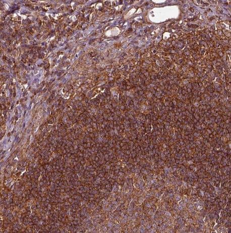 Immunohistochemistry-Paraffin: FAM21A Antibody [NBP2-57472] -Staining of human lymph node shows strong cytoplasmic granular positivity in non-germinal center cells.