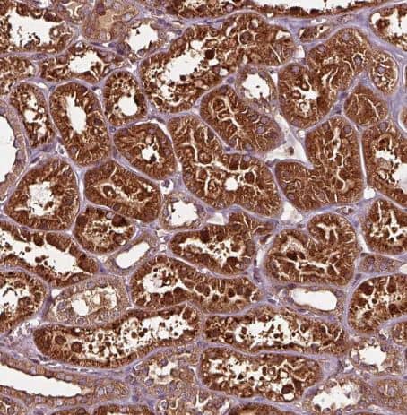 Immunohistochemistry-Paraffin: FAM21A Antibody [NBP2-57472] -Staining of human kidney shows strong cytoplasmic granular positivity in cells in tubules