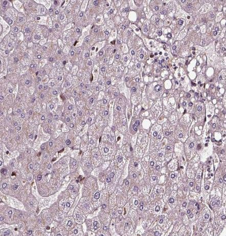 Immunohistochemistry-Paraffin: FAM21A Antibody [NBP2-57472] -Staining of human liver shows very weak positivity in hepatocytes.