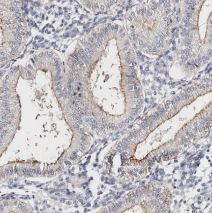 Immunohistochemistry-Paraffin: ROM1 Antibody [NBP2-58068] - Staining of human endometrium shows moderate membranous positivity in glandular cells.