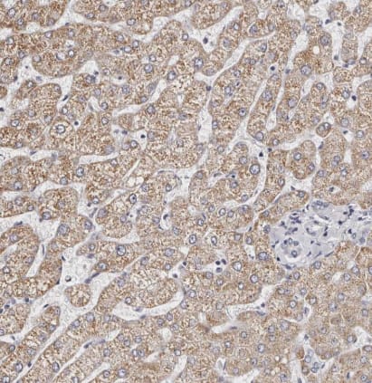 Immunohistochemistry-Paraffin: ROM1 Antibody [NBP2-58068] - Staining of human liver shows moderate cytoplasmic positivity in hepatocytes.