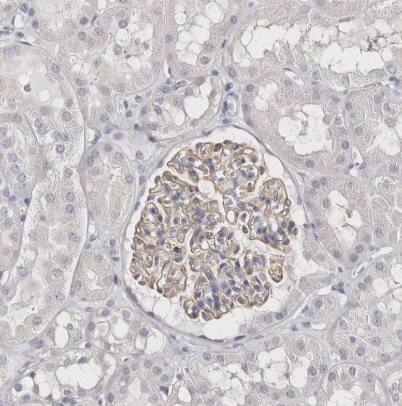 Immunohistochemistry-Paraffin: ROM1 Antibody [NBP2-58068] - Staining of human kidney shows moderate membranous positivity in cells in glomeruli.