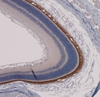 Immunohistochemistry-Paraffin: ROM1 Antibody [NBP2-58068] -Staining of rat eye shows strong cytoplasmic positivity in photoreceptor cells in retina.