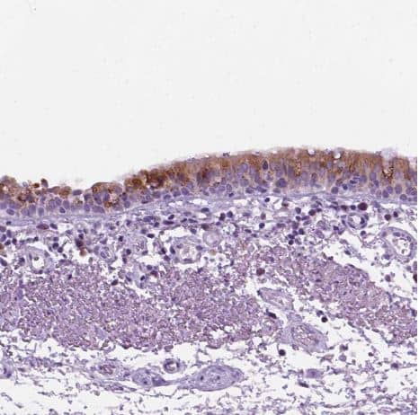 Staining of human bronchus shows strong positivity in respiratory epithelial cells.